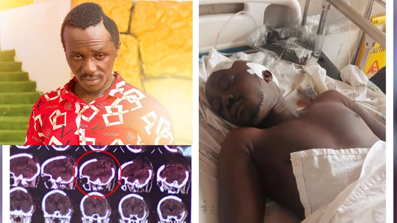 Bro Ronnie prays for a man who was attacked by robbers, beaten and left badly shuttered with his skull cracked.